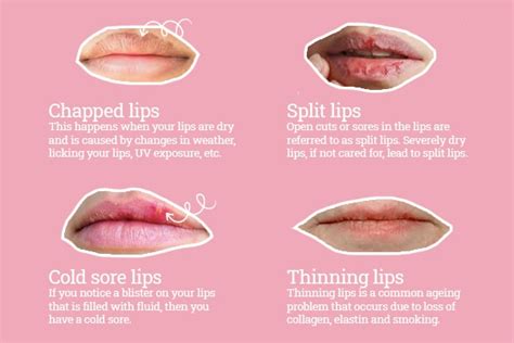 From Cracked to Smooth: Doctor Mafic Lip Repair Gel Transformation